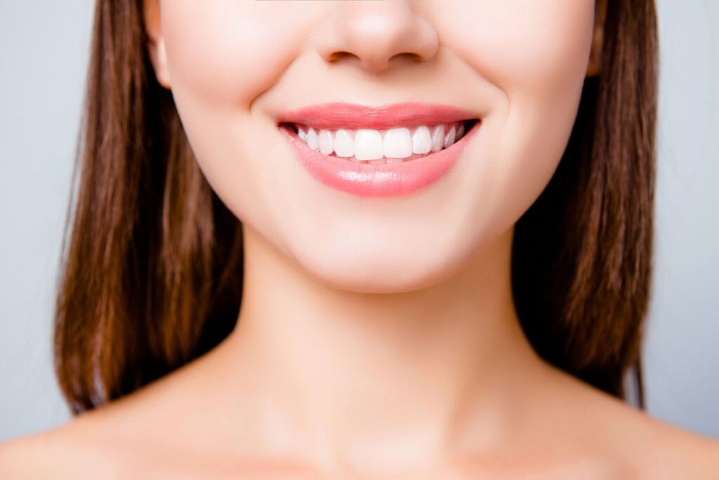 zoomed and cropped image of a woman's bright white smile worn teeth restorative dentistry dentist in Gaithersburg Maryland
