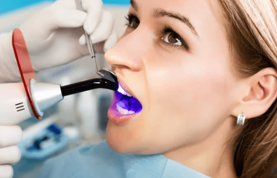 Tooth Bonding and Oral Health