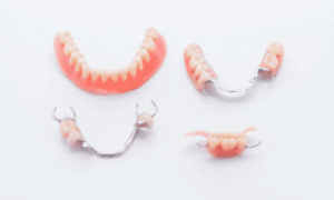 Restoring your smile after a tooth extraction involves several steps. Consulting with a dentist is crucial.